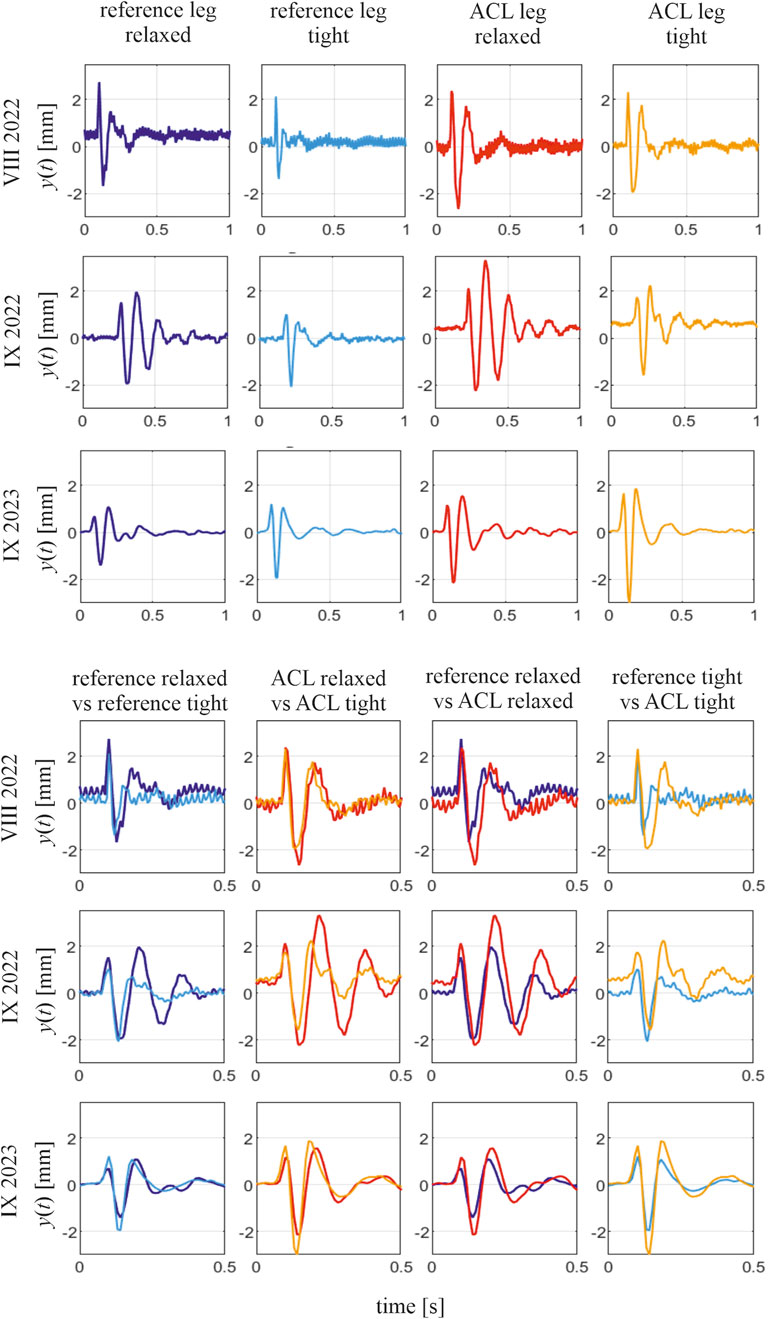 A grid of graphs shows y(t) in millimeters over time in seconds. The top section presents data for reference and ACL legs under relaxed and tight conditions across three dates: August 2022, September 2022, and September 2023. The bottom section compares different conditions between reference and ACL legs for the same dates. Each graph features colored lines denoting specific conditions, highlighting variations in movement.