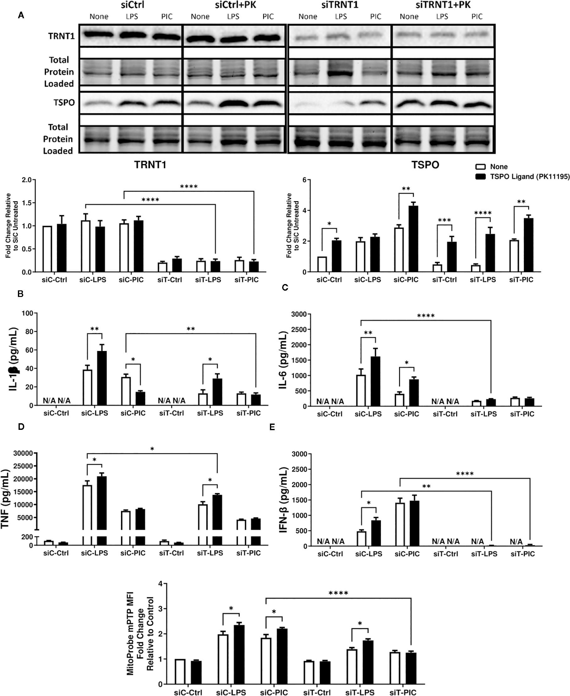 Western blots and bar graphs analyzing TRNT1 and TSPO expressions with siRNA treatments, PK11195 ligand, and inflammatory stimuli. Bar graphs depict fold changes and cytokine levels (IL-1β, IL-6, TNF, IFN-β). Significant levels are indicated with asterisks.