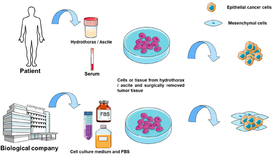 Flowchart of tumor cell culture using autologous body fluids versus traditional models. Patient-derived pleural/ascitic fluid or serum is used to culture tumor cells from fluid or resected tissue, reducing mesothelial cell overgrowth compared to fetal bovine serum-based methods.