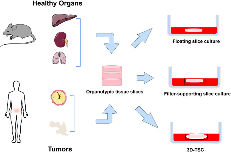 Illustration showing the process of creating organotypic tissue slices from healthy organs and tumors, both from mice and humans. The tissue slices are cultured using three methods: floating slice culture, filter-supporting slice culture, and 3D-TSC. Arrows indicate the progression from organ to culture method.