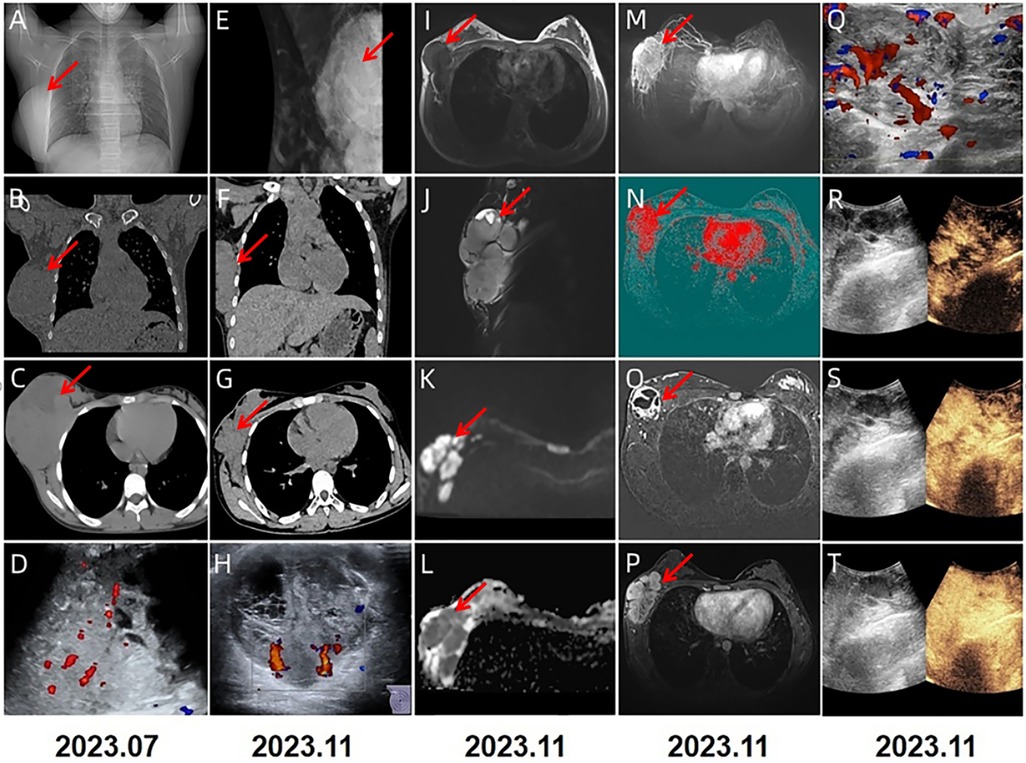 A series of medical imaging photographs show various scans including X-rays, MRIs, CT scans, and ultrasounds, illustrating physiological areas marked with red arrows. Different types of tissues and anomalies are highlighted across the images captured between July 2023 and November 2023. The images include color Doppler ultrasounds with color-coded blood flow and overlays displaying density variations. Each type of scan provides specific views and details for diagnostic purposes.