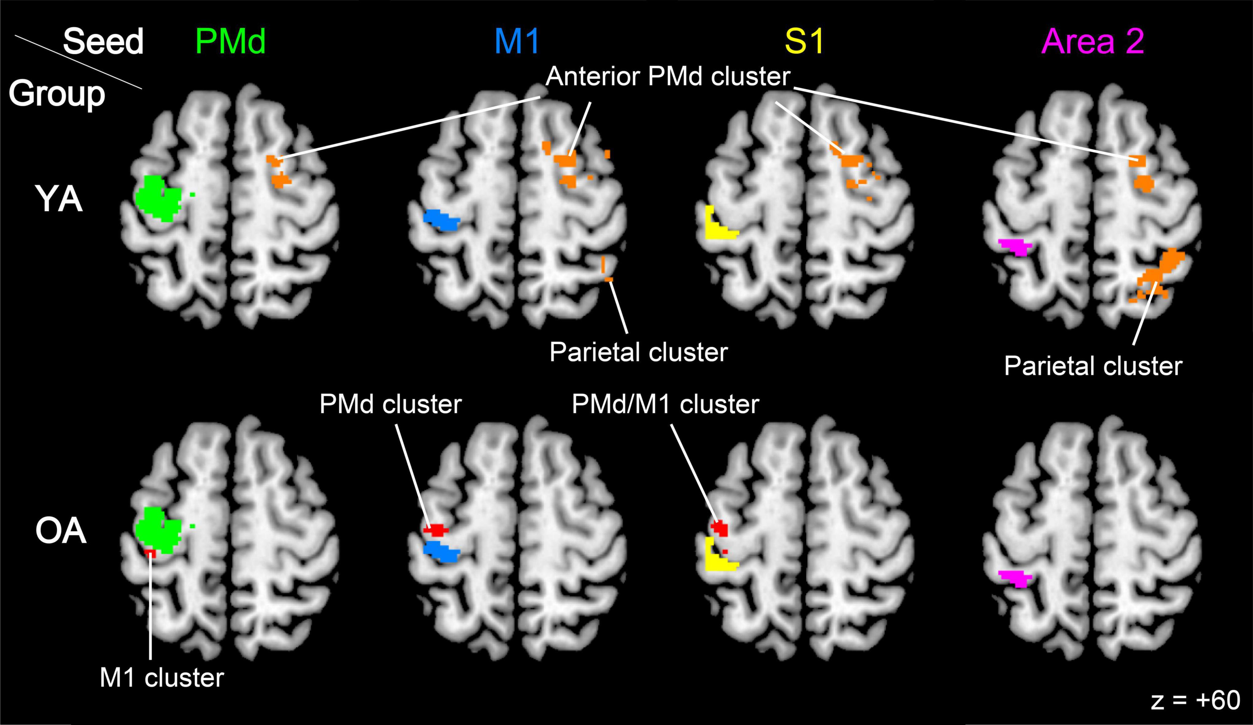 The figure shows connectivity results during the stick-rotation task compared to the button-press task, with seed regions placed in the contralateral PMd (green), M1 (blue), S1 (yellow), and Area 2 (magenta). Brain areas showing increased functional connectivity with each seed are displayed for younger (YA, top row) and older (OA, bottom row) adults. In the YA group, all seeds showed enhanced connectivity with the ipsilateral anterior PMd. In contrast, in the OA group, increased connectivity was observed within the contralateral ROI for the PMd, M1, and S1 seeds.