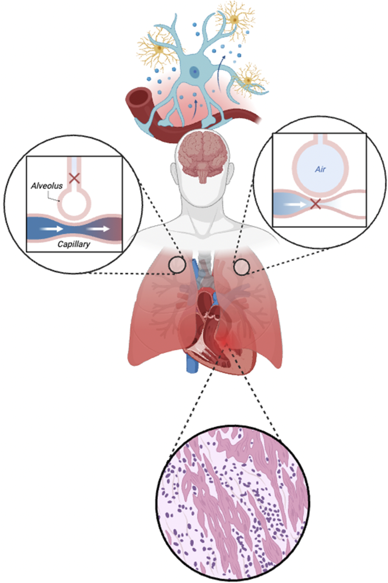 Illustration of a human body showing the lungs, brain, and neurons. The image includes magnified views of alveolus and capillary interaction, indicating respiratory function, and a detailed view of lung tissue, highlighting cellular structures. Neurons are depicted above the brain, with capillaries illustrated nearby.