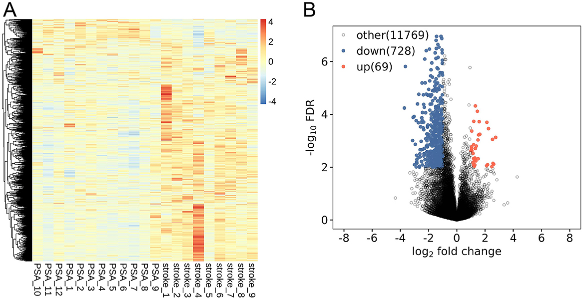 Panel A displays a heatmap indicating gene expression data across PSA and stroke samples, with colors ranging from blue to red, representing values from -4 to 4. Panel B illustrates a volcano plot showing gene expression changes with blue dots indicating downregulated genes, red dots indicating upregulated genes, and other genes in gray. The axes represent log2 fold change and negative log10 false discovery rate (FDR).
