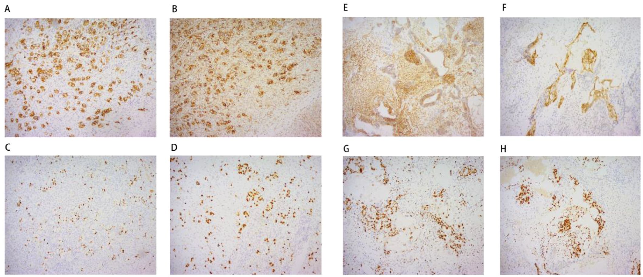 Microscopic images A to H show tissue samples with varying patterns and densities of brown staining, indicative of different levels of protein expression. Each panel exhibits distinct distribution and concentration, providing visual data for comparative analysis.