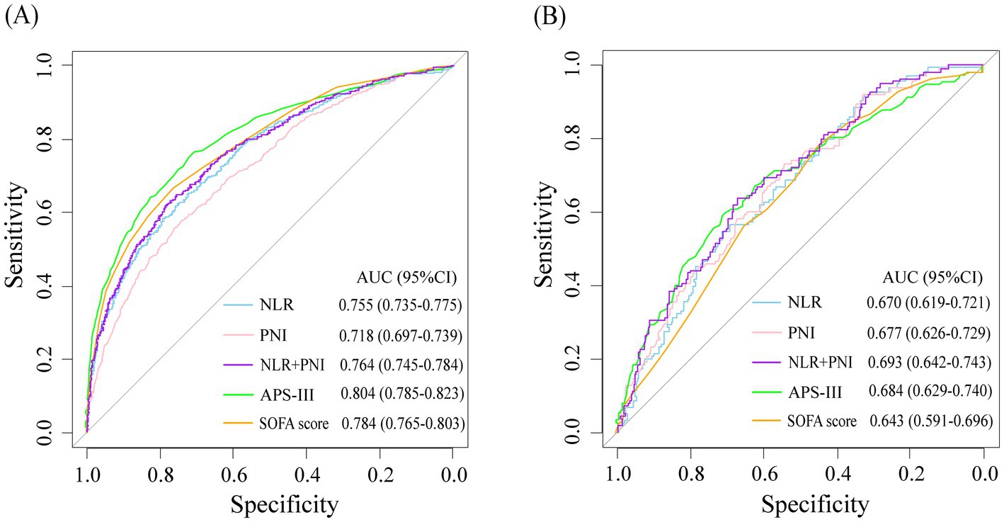Receiver Operating Characteristic (ROC) curves show sensitivity versus specificity for various metrics. Panel A displays curves for NLR, PNI, NLR+PNI, APS-III, and SOFA score, with AUC values ranging from 0.718 to 0.804. Panel B shows similar metrics, with AUC values from 0.643 to 0.693.