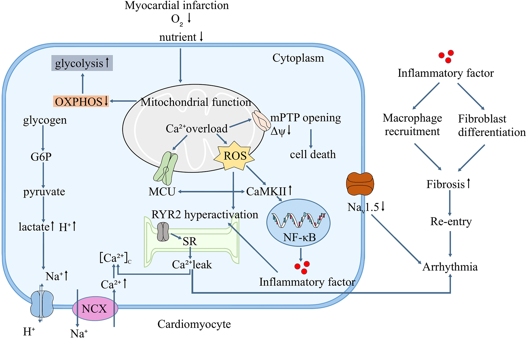 Diagram depicting the cellular pathways involved in myocardial infarction. It shows decreased oxygen and nutrients leading to mitochondrial dysfunction, Ca²+ overload, and ROS production, causing cell death. Inflammatory factors lead to macrophage recruitment, fibroblast differentiation, fibrosis, re-entry, and arrhythmia. Pathways involve glycolysis, MCU, mPTP opening, RYR2 hyperactivation, and NF-κB activation. Nav1.5 channel decrease and NCX activity are also illustrated.