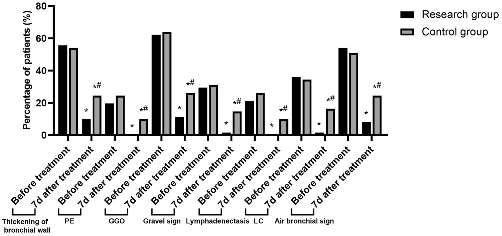 Bar graph comparing the percentage of patients in research and control groups with various lung conditions before and seven days after treatment. Conditions include thickening of bronchial wall, PE, GGO, gravel sign, lymphadenectasis, LC, and air bronchial sign. The research group showed significant improvement after treatment, indicated by asterisks and number signs.