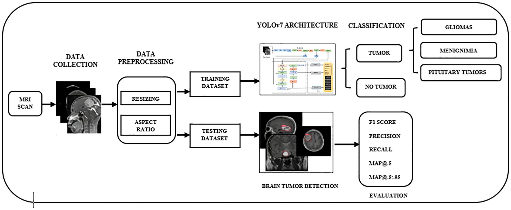 Flowchart outlining a brain tumor detection system. Steps include MRI scan data collection, preprocessing with resizing and aspect ratio adjustments, and creating training and testing datasets. The YOLOv7 architecture classifies images into tumor categories: gliomas, meningioma, pituitary tumors, or no tumor. Evaluation metrics include F1 score, precision, recall, MAP at point five and point five to point ninety-five.