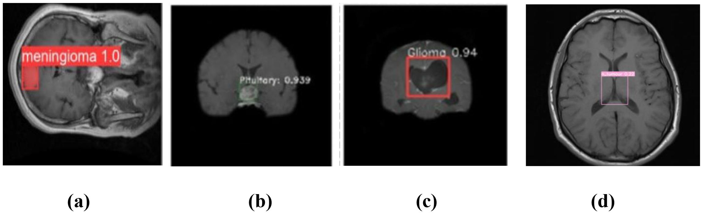 Four MRI images of the brain with labels. (a) Shows a region marked as “meningioma 1.0” in red. (b) Indicates “Pituitary: 0.939” in white text. (c) Highlights “Glioma 0.94” in red. (d) Displays a faintly marked “tumour 0.22” in pink.