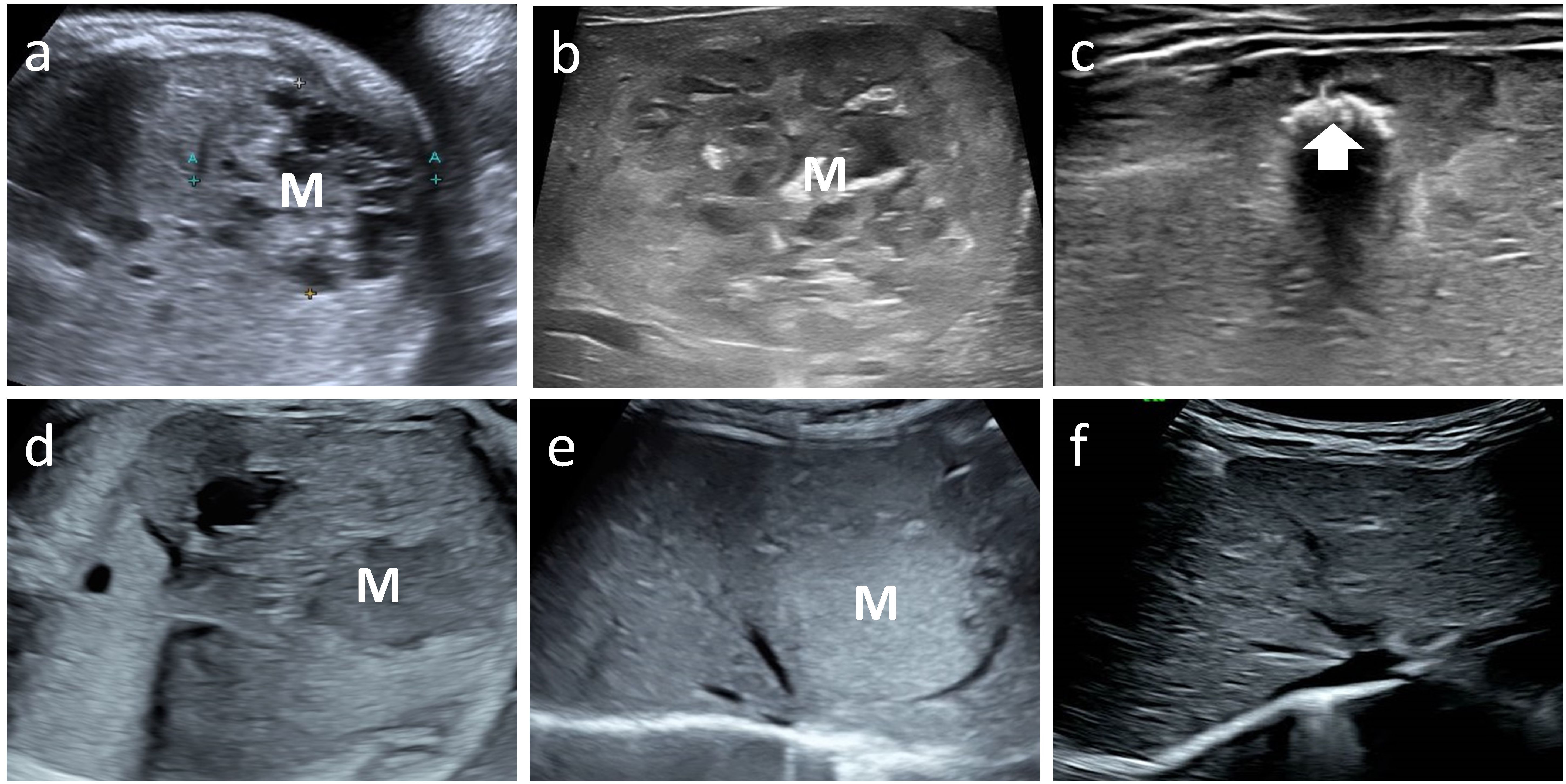 Ultrasound images labeled a to f. Panels a, b, d, and e show cross-sections with a marked “M”, likely indicating an area of interest. Panel c displays an area with a highlighted section marked by an arrow. Panel f has a different orientation or view, depicting varied tissue structure.