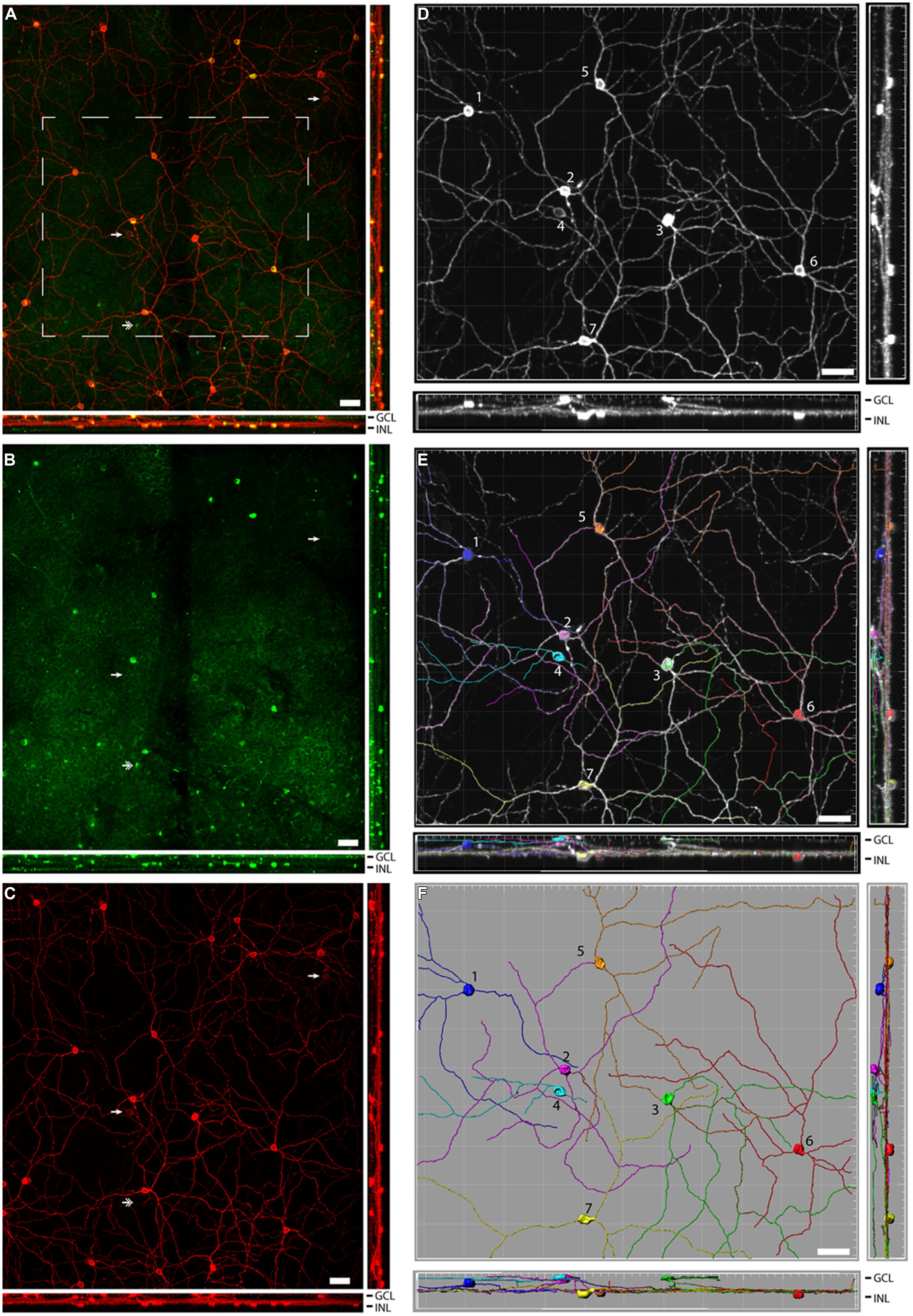 Vesicular glutamate transporter 2 (VGLUT2) is co-stored with PACAP in  projections from the rat melanopsin-containing retinal ganglion cells