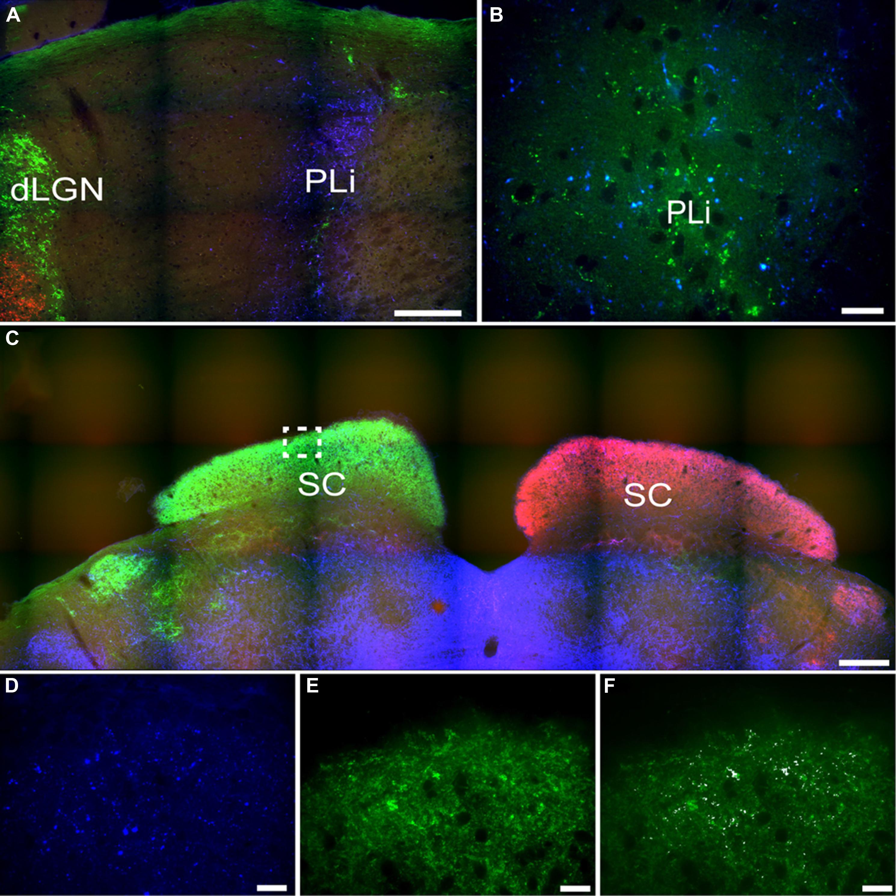 Vesicular glutamate transporter 2 (VGLUT2) is co-stored with PACAP in  projections from the rat melanopsin-containing retinal ganglion cells