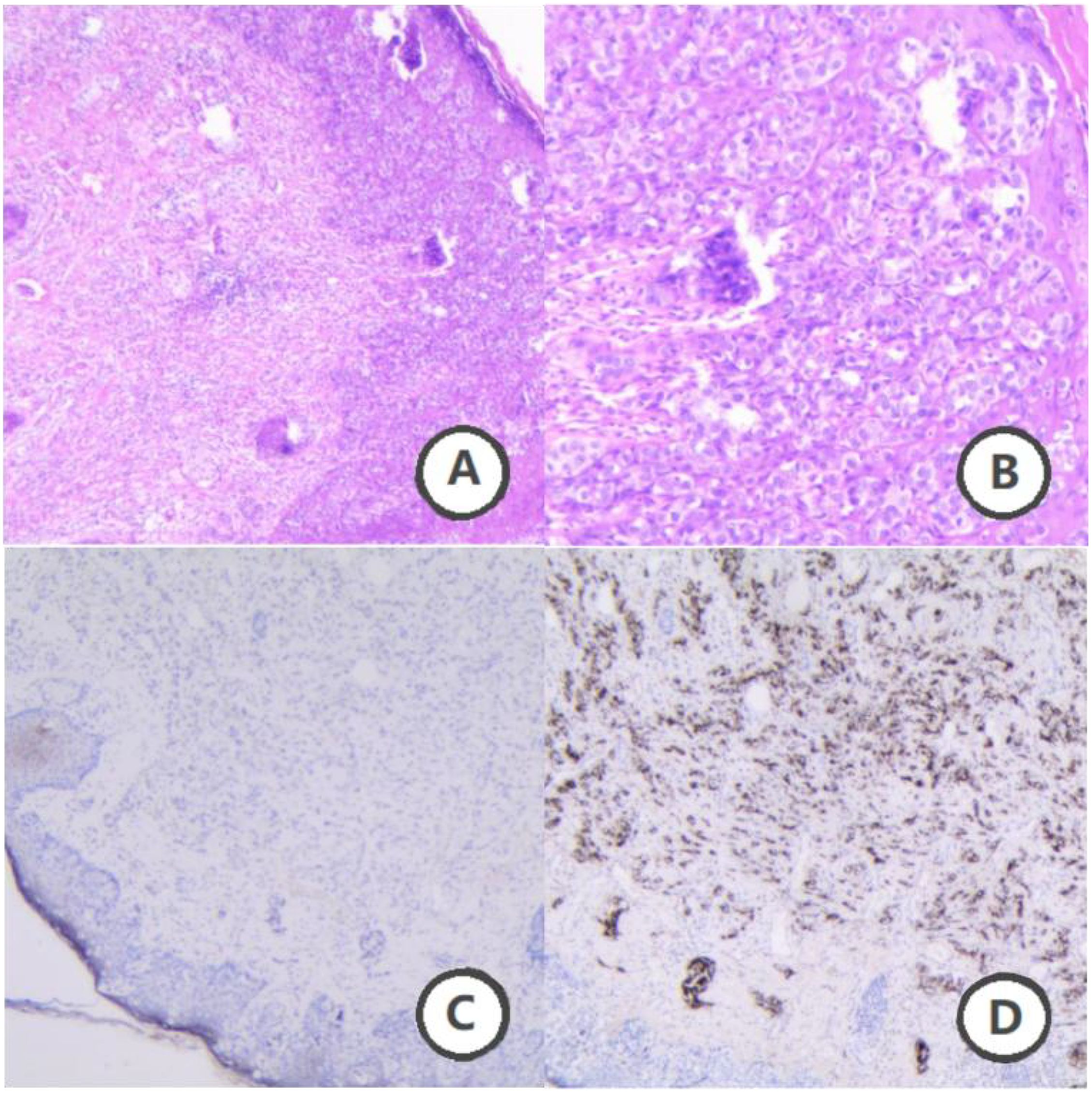 Histological images labeled A, B, C, and D. A shows a low magnification view with dense cell clusters. B presents a higher magnification of similar tissue with distinct cell structure. C depicts tissue with lighter staining, while D shows detailed, darker staining patterns, indicating varied cellular or structural features.