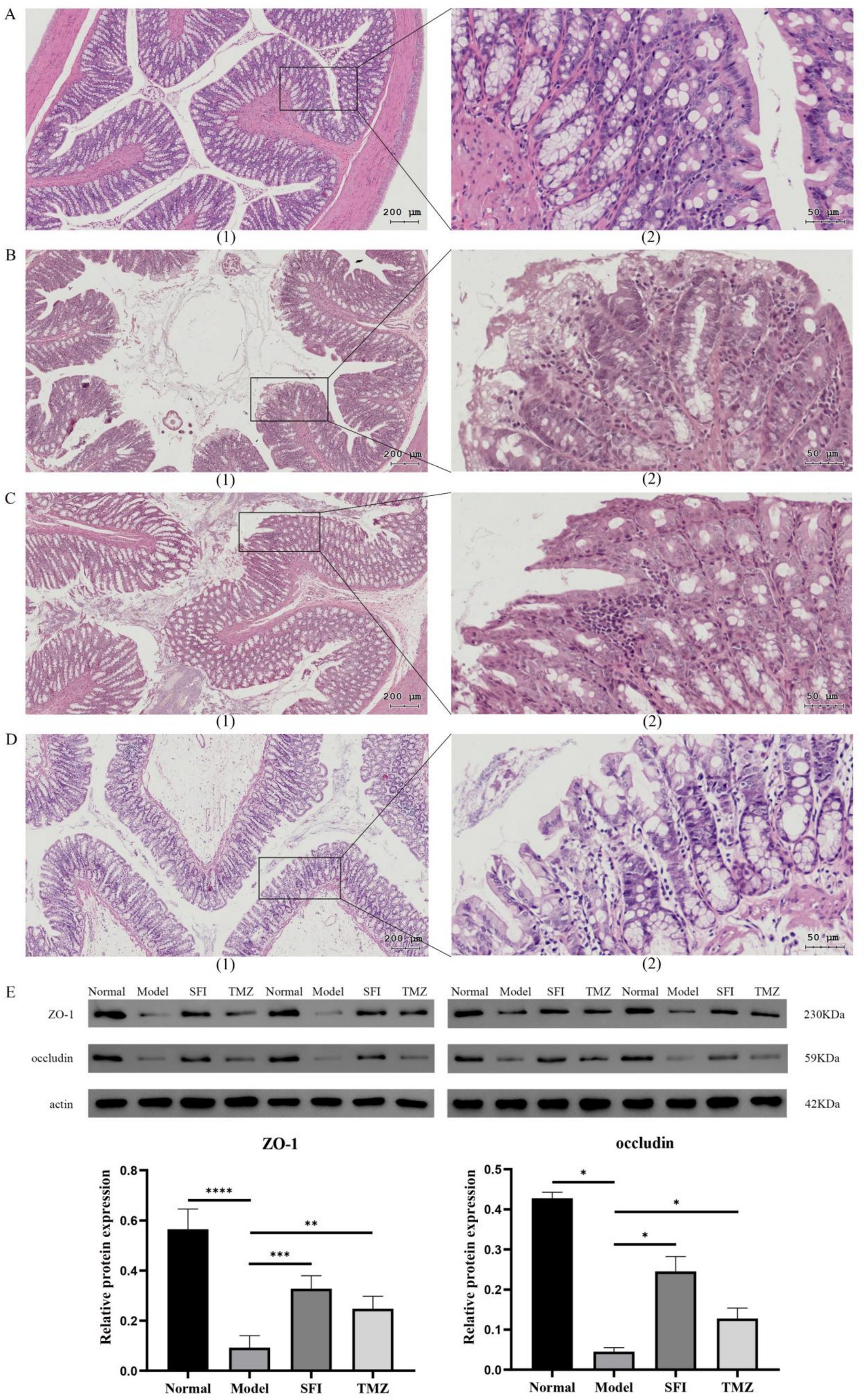 Frontiers | Cardiac energy metabolic disorder and gut