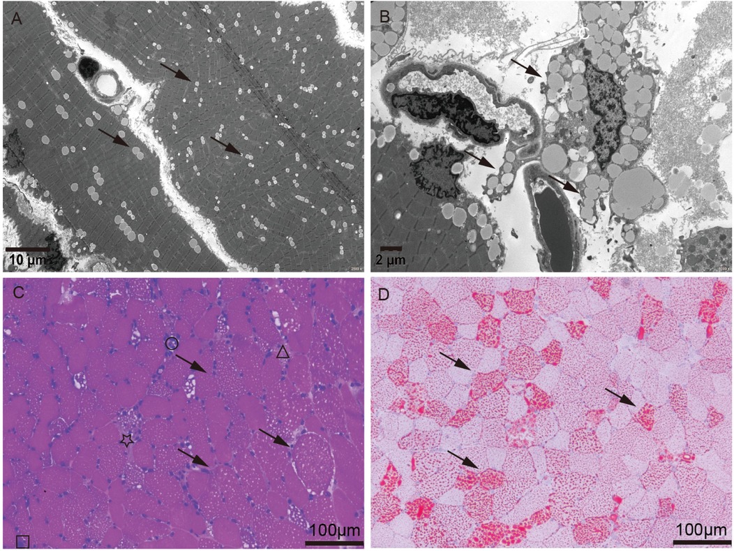 Panel A shows a microscopic view of muscle tissue with striations and circular structures highlighted by arrows. Panel B displays detailed cellular components with varying shapes and sizes. Panel C presents a cross-section of muscle tissue stained purple, indicating different cell types and shapes. Panel D shows a red-stained muscle tissue with visible fiber patterns, marked by arrows. Each panel includes a scale bar for reference.