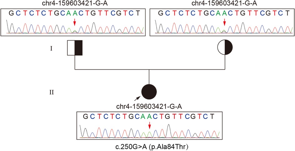 Genetic pedigree chart showing a mutation in the sequence chr4-159603421-G-A, indicated by arrows. Three family members are illustrated. The child in generation II has a complete mutation at c.250G>A (p.Ala84Thr).
