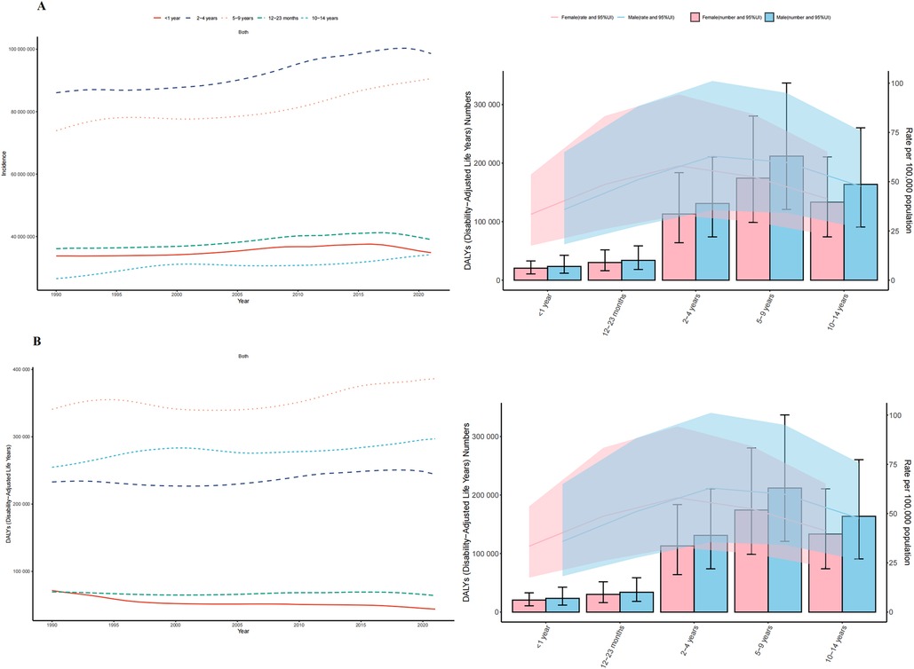 Two charts showing trends in otitis media incidence and Disability-Adjusted Life Years (DALYs) among children from 1990 to 2021. Panel A displays trends in incident cases and incidence rates across age groups: under 1 year, 1-2 years, 2-4 years, 5-9 years, and 10-14 years. Panel B shows trends in DALYs cases and rates over the same period. Both panels depict data stratified by gender with error bars indicating the ninety-five percent uncertainty interval.