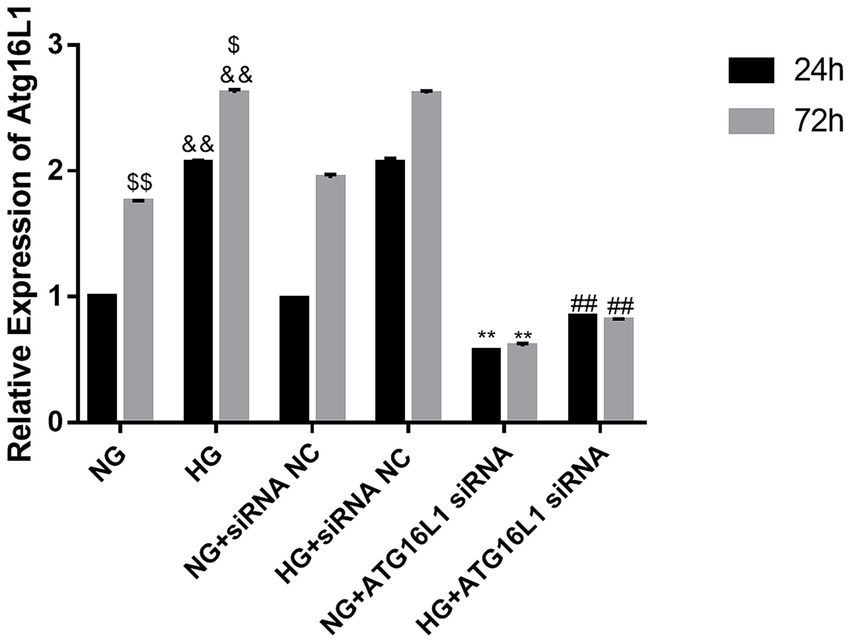 Bar graph showing relative expression of Atg16L1 under different conditions labeled NG, HG, NG+siRNA NC, HG+siRNA NC, NG+ATG16L1 siRNA, and HG+ATG16L1 siRNA. Results are recorded at 24 hours (black bars) and 72 hours (gray bars). Bars indicate varied expression levels, with HG conditions having higher expressions than NG. Statistical significance is denoted by symbols above each bar, such as $, &, #, and **.