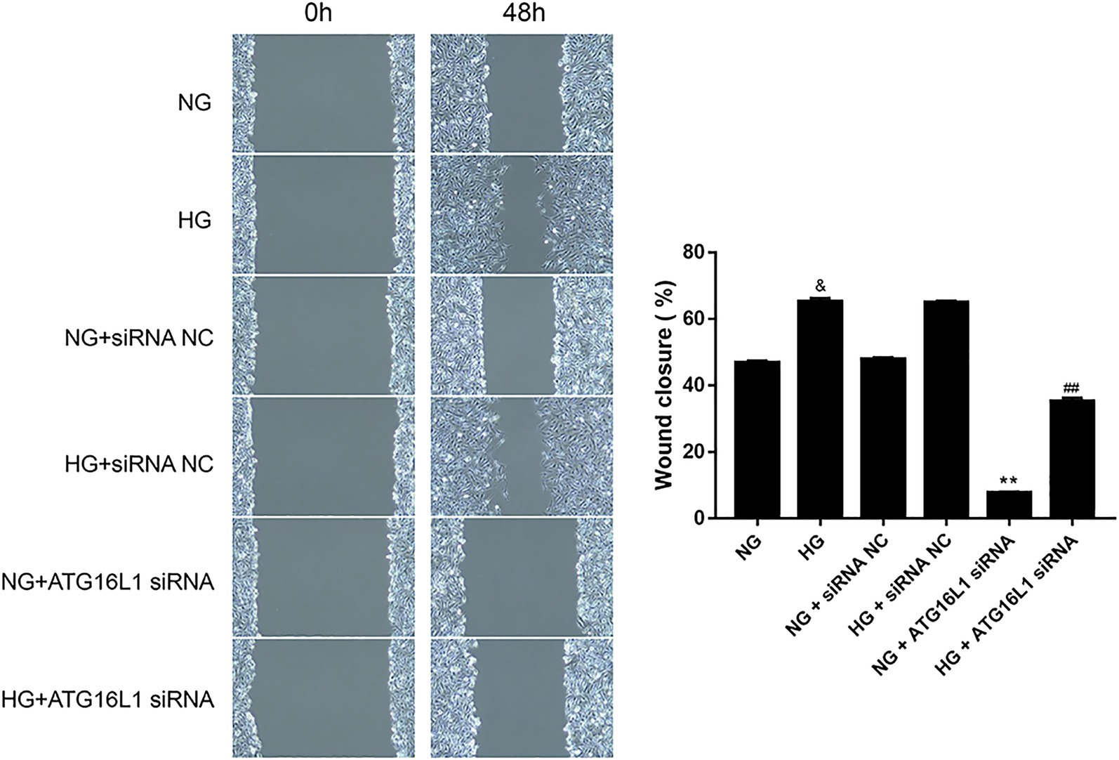Microscopic images on the left show wound healing in cells at 0 and 48 hours under different conditions: NG, HG, NG+siRNA NC, HG+siRNA NC, NG+ATG16L1 siRNA, and HG+ATG16L1 siRNA. On the right, a bar graph illustrates wound closure percentages for these conditions, showing a significant reduction in closure with HG+ATG16L1 siRNA compared to others.