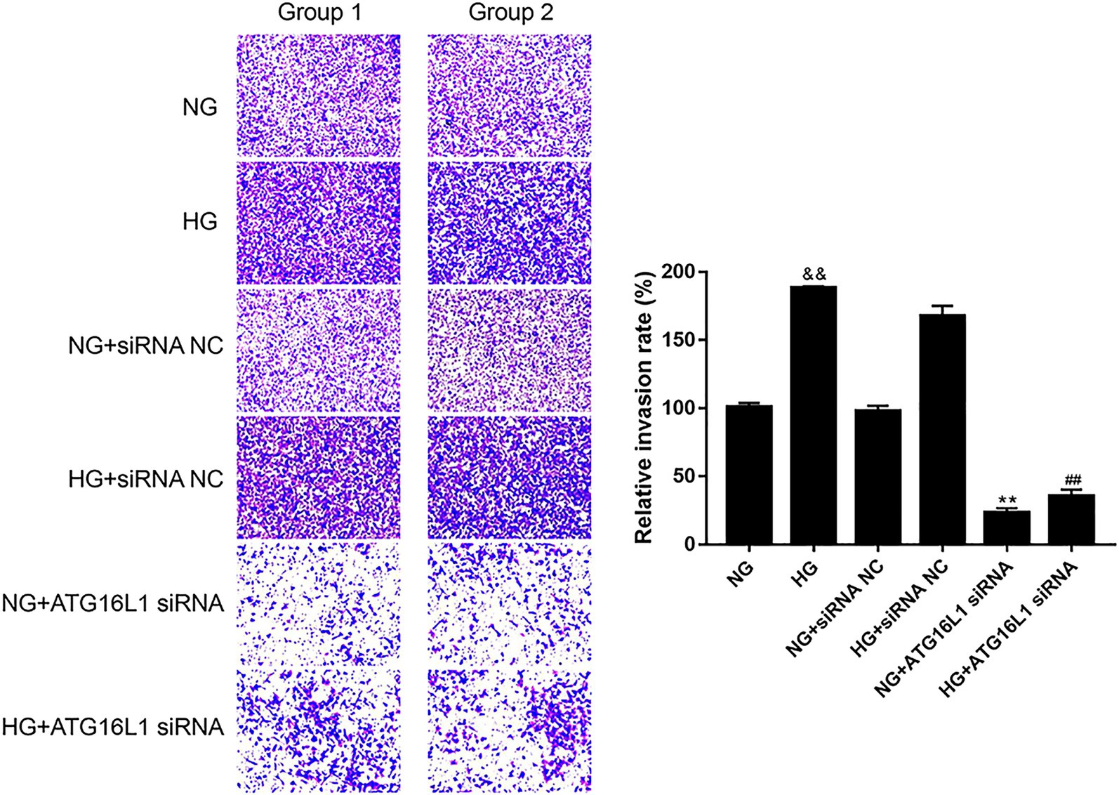 Two columns of cell invasion assay images for Group 1 and Group 2 show varying invasion densities under different conditions: NG, HG, NG+siRNA NC, HG+siRNA NC, NG+ATG16L1 siRNA, HG+ATG16L1 siRNA. A bar graph compares the relative invasion rate (%) for each condition, indicating significant variation.
