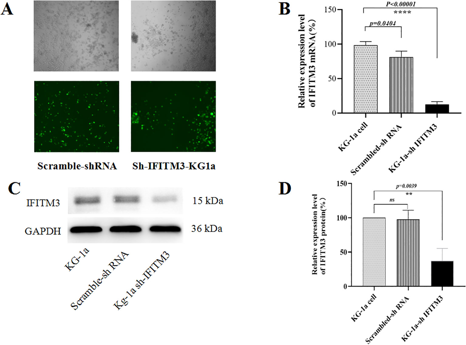 A panel of four images and graphs labeled A to D: A: Microscopic images showing two sets of KG1a cells treated with Scramble-shRNA and Sh-IFITM3, with fluorescence indicating cell presence. B: Bar graph depicting the relative expression levels of IFITM3 mRNA in KG1a cells, Scramble-shRNA, and KG1a-sh IFITM3 treated cells, highlighting significant differences (p-values: <0.00001, 0.0104). C: Western blot analysis showing IFITM3 and GAPDH protein levels in KG1a, Scramble-shRNA, and KG1a sh-IFITM3 samples. D: Bar graph showing relative IFITM3 protein expression levels in the same cell treatments, indicating statistical significance (p-value: 0.0039).