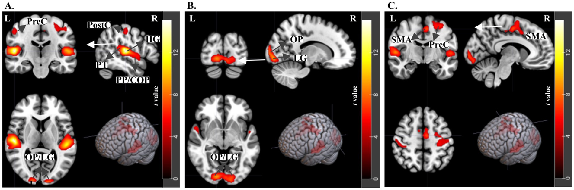 Brain imaging scans labeled A, B, and C. Each panel shows different brain regions highlighted in red and yellow, indicating areas of activation. Labels like PreC, PostC, HG, OP, LG, and SMA are used to identify specific anatomical areas. A gradient scale beside each scan shows the t-value range from zero to twelve.