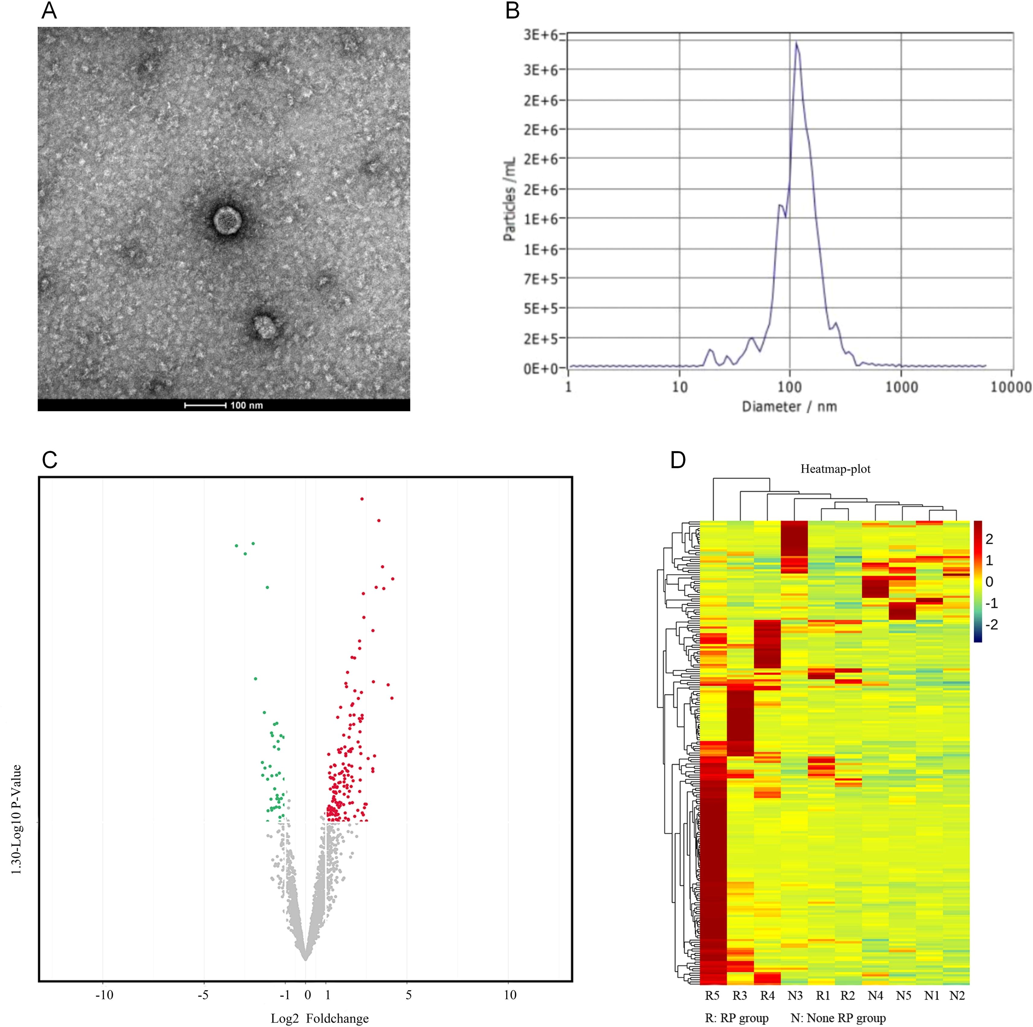Panel A shows a transmission electron microscopy image of spherical particles. Panel B is a line graph depicting particle size distribution, peaking around 100 nanometers. Panel C is a volcano plot showing significant data points, with colors indicating positive or negative fold changes. Panel D is a heatmap displaying data clustering, with a color scale from blue to red indicating values from -2 to 2, comparing RP and non-RP groups.
