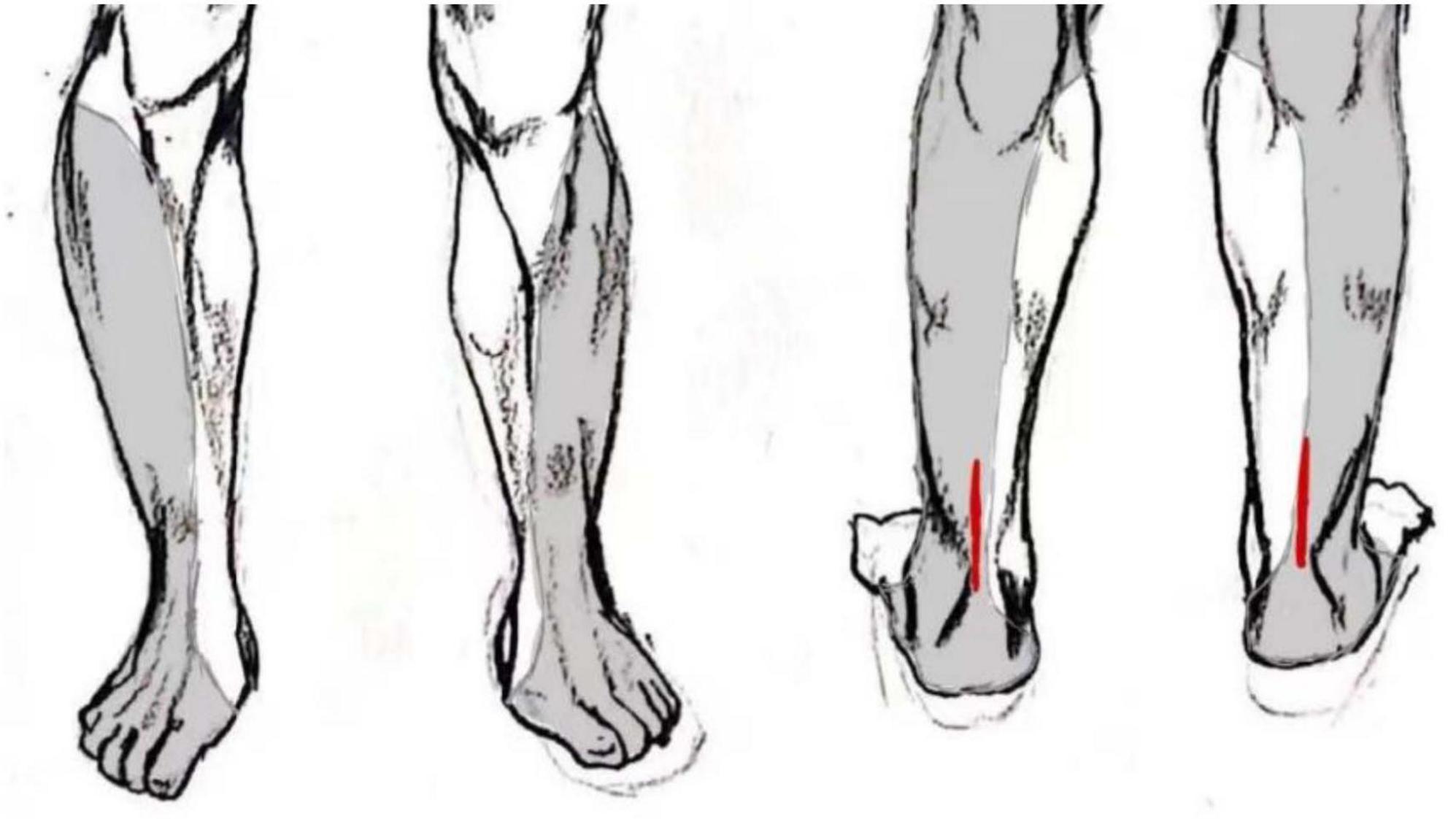 Three illustrations show a lower leg and foot from different angles. The first two highlight muscle anatomy, while the third shows a rear view with red lines indicating the Achilles tendon.