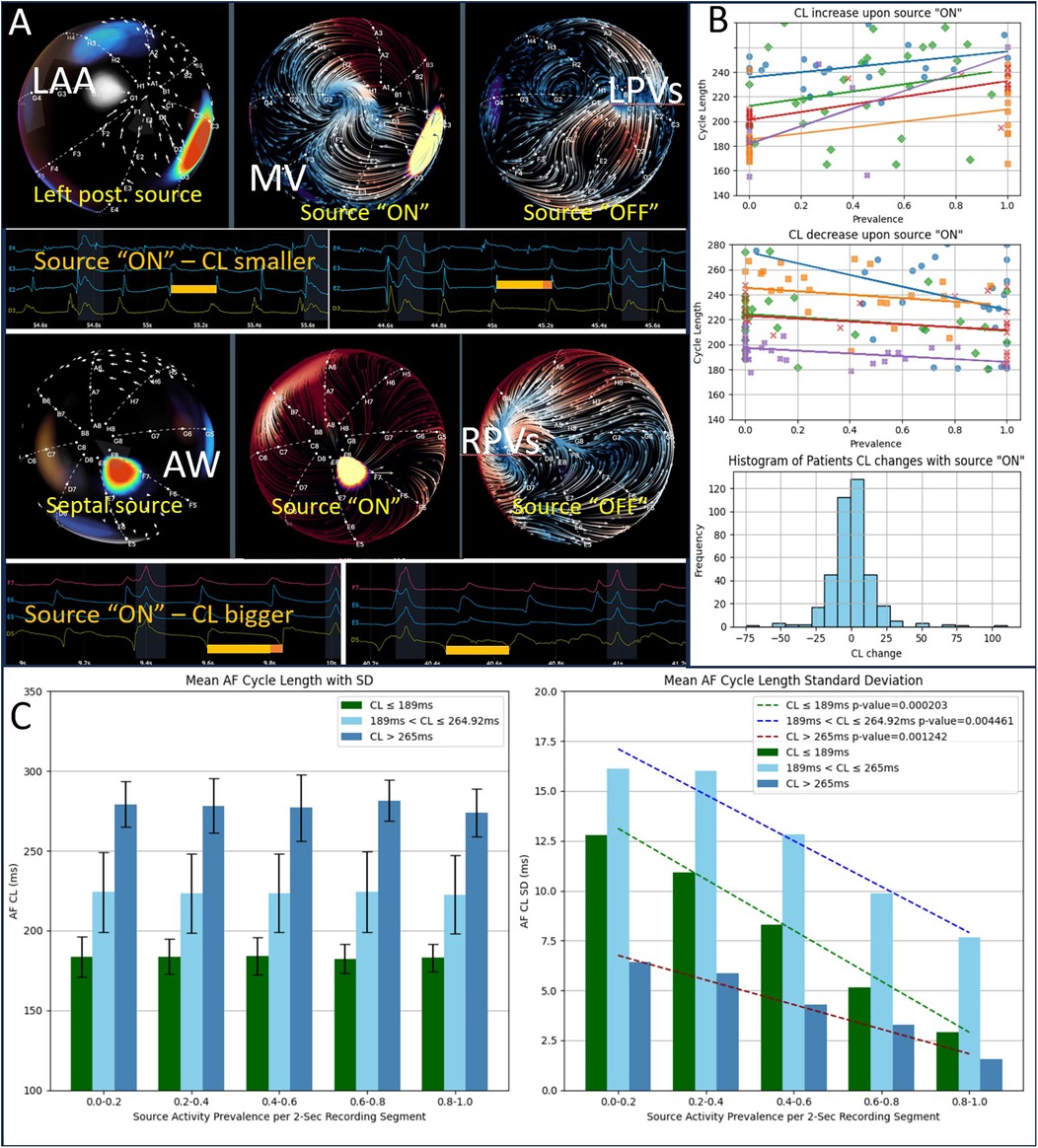 Panel A shows color-coded heart images with labeled areas LAA, MV, LPVs, AW, and RPVs, comparing source activity labeled as \