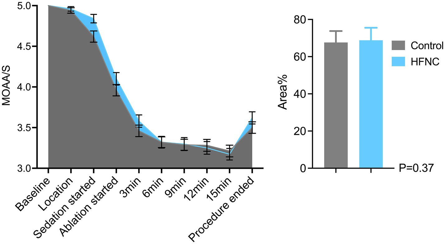 Line graph and bar chart comparing patient sedation levels during a medical procedure. The line graph shows MOAA/S scores decreasing from baseline to ablation start and then stabilizing. The bar chart compares area percentages between control (grey) and HFNC (blue) groups, with similar values around seventy percent and a p-value of 0.37.