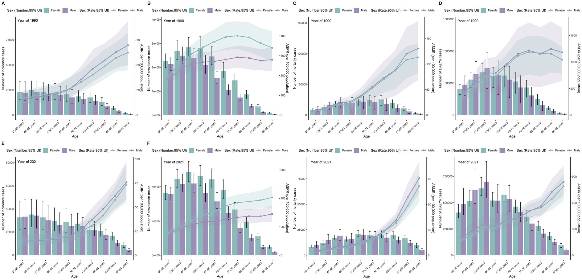 Nine bar and line graphs compare health data for males and females in 1990 and 2021 across different age groups. The graphs show the number of incidence cases, prevalence cases, mortality cases, and DALYs per age group. The graphs highlight differences in health outcomes between sexes over time, with shaded areas representing uncertainty intervals.