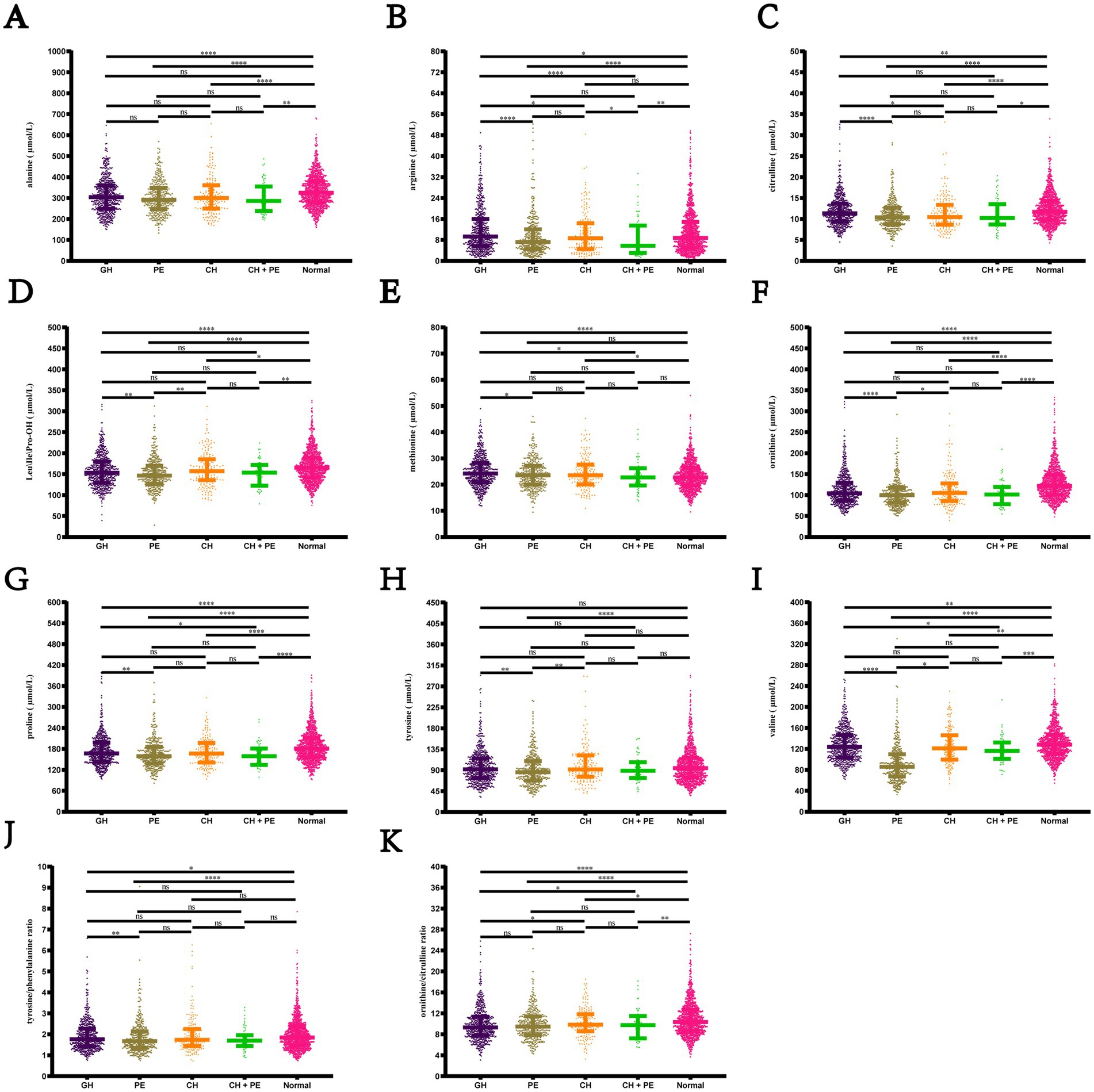 Eleven scatter plots (labeled A to K) display measurement distributions for five groups: GH, PE, CH, CH+PE, and Normal. Each plot compares different variables with statistical significance indicated by asterisks above group comparisons.