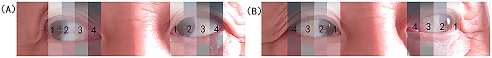 Two side-by-side images labeled A and B show close-ups of human eyes divided into four vertical striped segments labeled 1 to 4. In image A, the numbers progress from left to right, and in image B, they progress from right to left. The stripes vary in color and transparency.