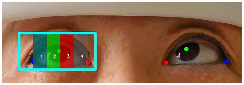 Close-up of two eyes with a rectangular overlay on the left eye. The overlay is divided into four vertical colored sections numbered one to four. Small dots in blue, green, and red appear near both eyes.
