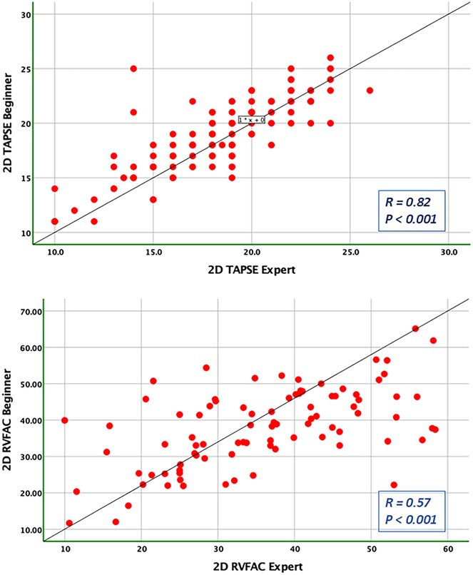 Two scatter plots display the correlation between measurements by beginners and experts. The top plot compares 2D TAPSE values with R = 0.82 and p < 0.001. The bottom plot compares 2D RVFAC values with R = 0.57 and p < 0.001. Red dots represent data points, and black lines indicate trend lines.