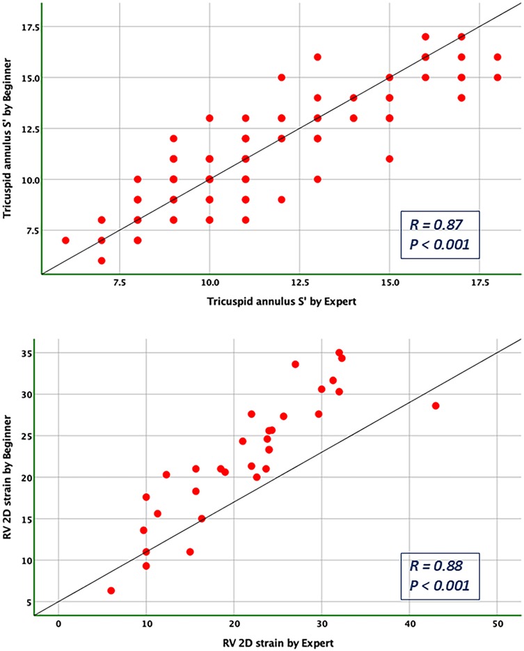 Scatter plots comparing measurements by beginners and experts. The top graph shows tricuspid annulus S' with a correlation of R = 0.87, P < 0.001. The bottom graph shows RV 2D strain with a correlation of R = 0.88, P < 0.001. Both graphs depict strong positive correlations.