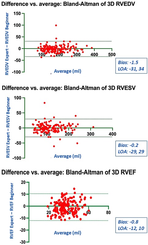 Three Bland-Altman plots show differences versus average measurements. The first plot presents 3D RVEDV with bias -1.5 and limits of agreement -31 to 34. The second plot shows 3D RVESV with bias -0.2 and limits of agreement -29 to 29. The third plot depicts 3D RVEF with bias -0.8 and limits of agreement -12 to 10. Red dots represent data points.