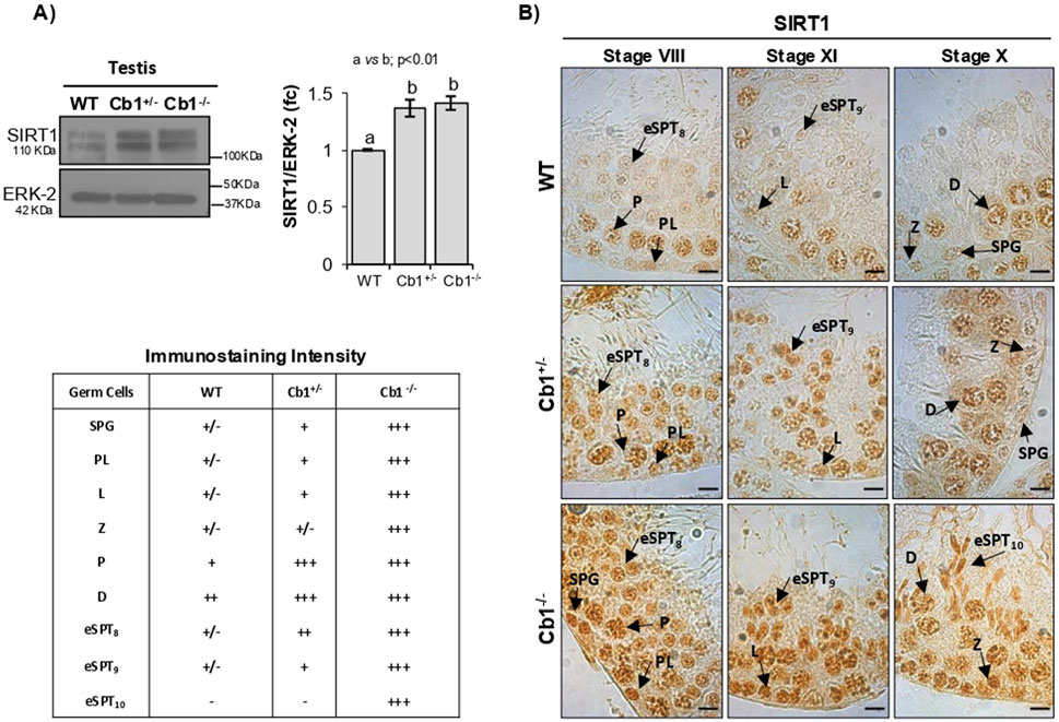 A composite image showing protein analysis and immunostaining in testis. A) On the left, a Western blot for SIRT1 and ERK-2 in WT, Cb1+/-, and Cb1-/- testis, with a graph indicating increased SIRT1/ERK-2 ratio in mutants. An immunostaining intensity table follows. B) Microscopic images display SIRT1 localization in testis at different stages (VIII, XI, X) across WT, Cb1+/-, and Cb1-/- samples, with varying staining intensities marked by arrows indicating specific germ cell types.