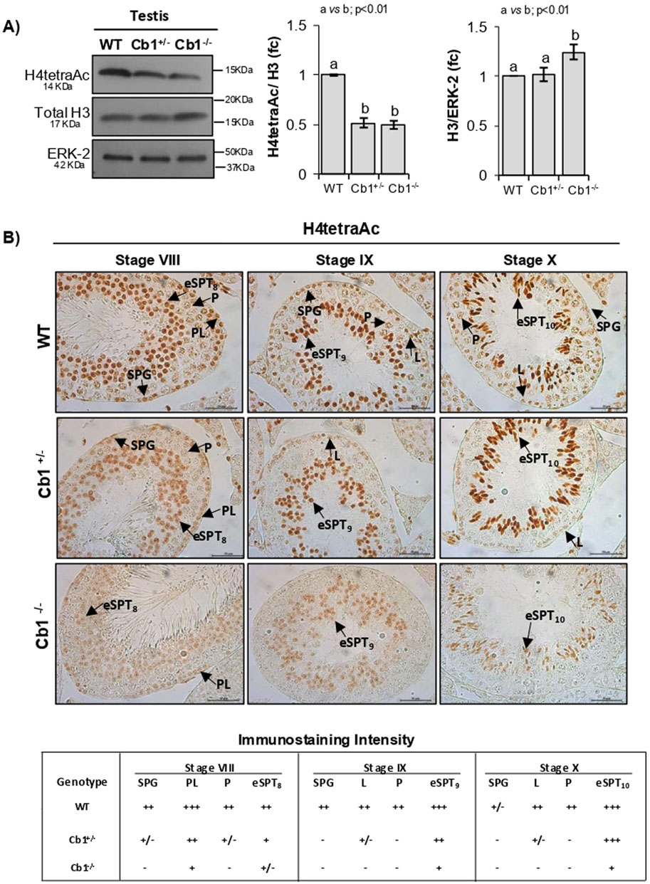 Panel A shows Western blot and bar graphs comparing H4tetraAc and H3 expression across genotypes WT, Cb1+/-, and Cb1-/-. Statistical significance is indicated. Panel B shows immunostaining of testes sections at stages VIII, IX, and X for WT, Cb1+/-, and Cb1-/- genotypes. Arrows indicate different cell types. The table below summarizes immunostaining intensity for different cell types and genotypes across stages.