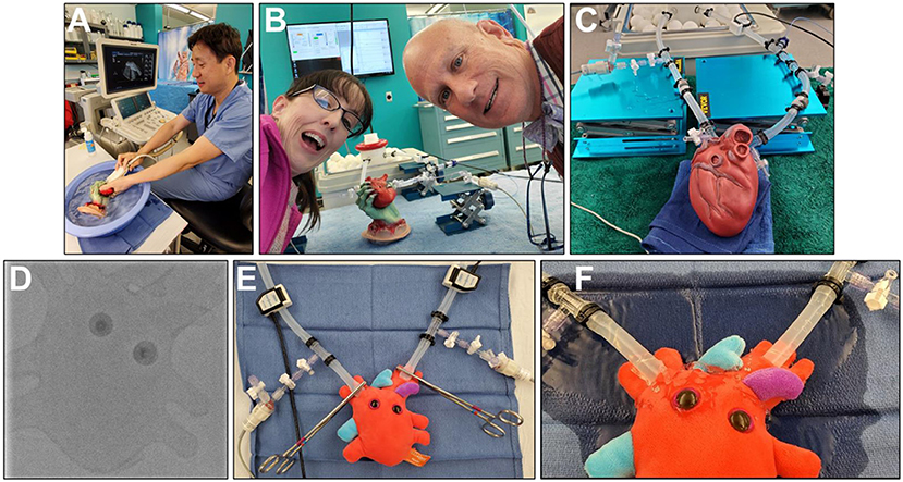 A collage of six images related to testing toy hearts. A: A person operates a cardiac ultrasound machine. B: Two people smile while standing next to their laboratory experiment. C: A photo showing a laboratory experiment. D: An X-ray image of a toy heart. E: Photo showing an experiment being performed on a toy heart. F: Photo showing a toy heart leaking water during an experiment.