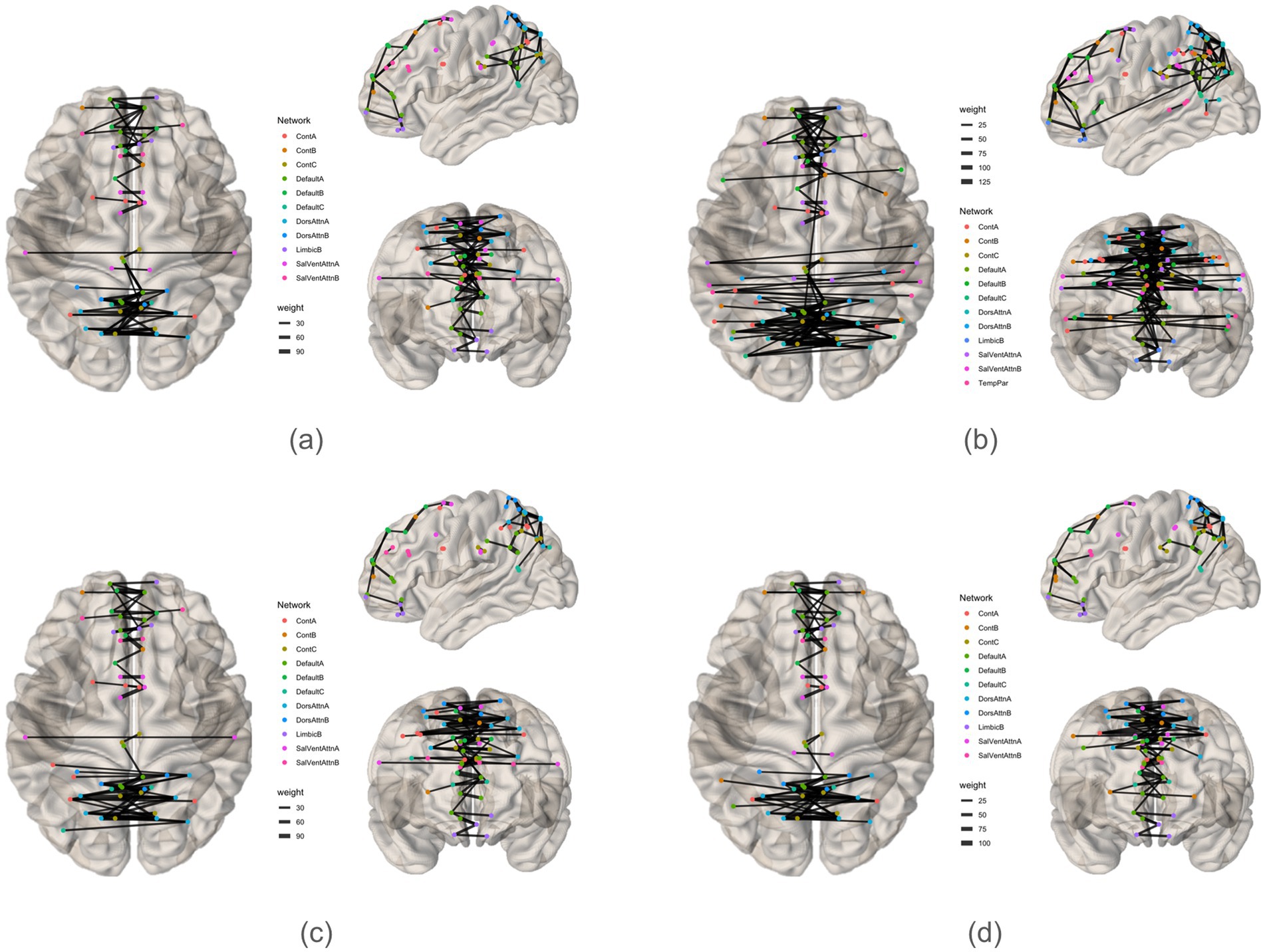 Four brain diagrams labeled (a) Initiation, (b) Inhibition, (c) Shifting, and (d) 2-back show neural networks with colored nodes and connecting lines. Networks include ContA, ContB, DefaultA, and others. Connection weights are indicated by varying line thickness, represented by a legend with weights from 30 to 125. Each diagram highlights different network connections and weights.