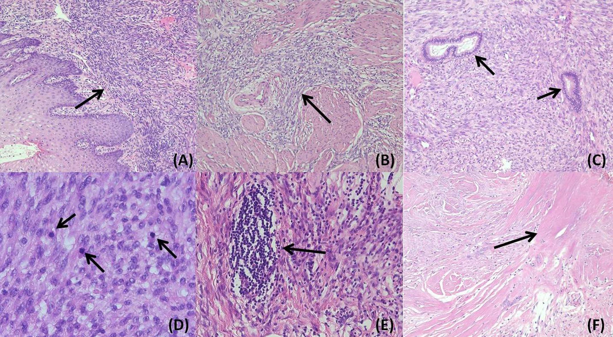 Microscopic images labeled A to F showing different tissue samples with arrows pointing to specific features. Image A shows stratified squamous epithelium. Image B highlights fibrous stroma. Image C indicates glandular structures. Image D focuses on cellular nuclei. Image E contains dense inflammatory infiltrate. Image F showcases collagen fibers.