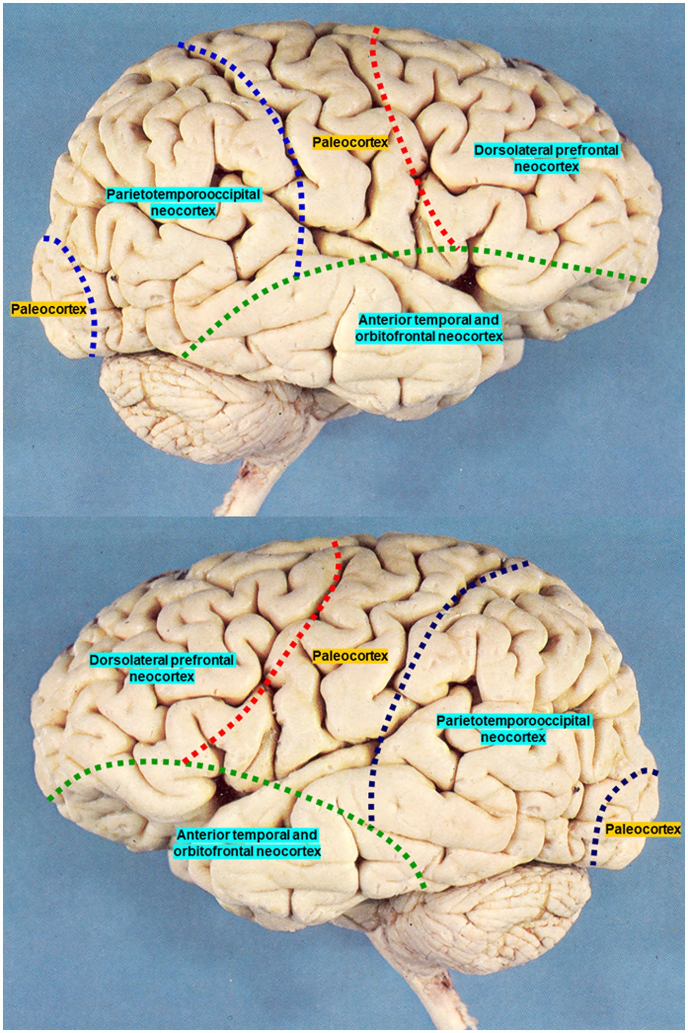 Illustration of the brain displaying different sections of the neocortex and paleocortex. Labels identify regions such as the dorsolateral prefrontal neocortex, parietotemporooccipital neocortex, anterior temporal and orbitofrontal neocortex, and areas of the paleocortex. Dashed lines in various colors delineate these regions.