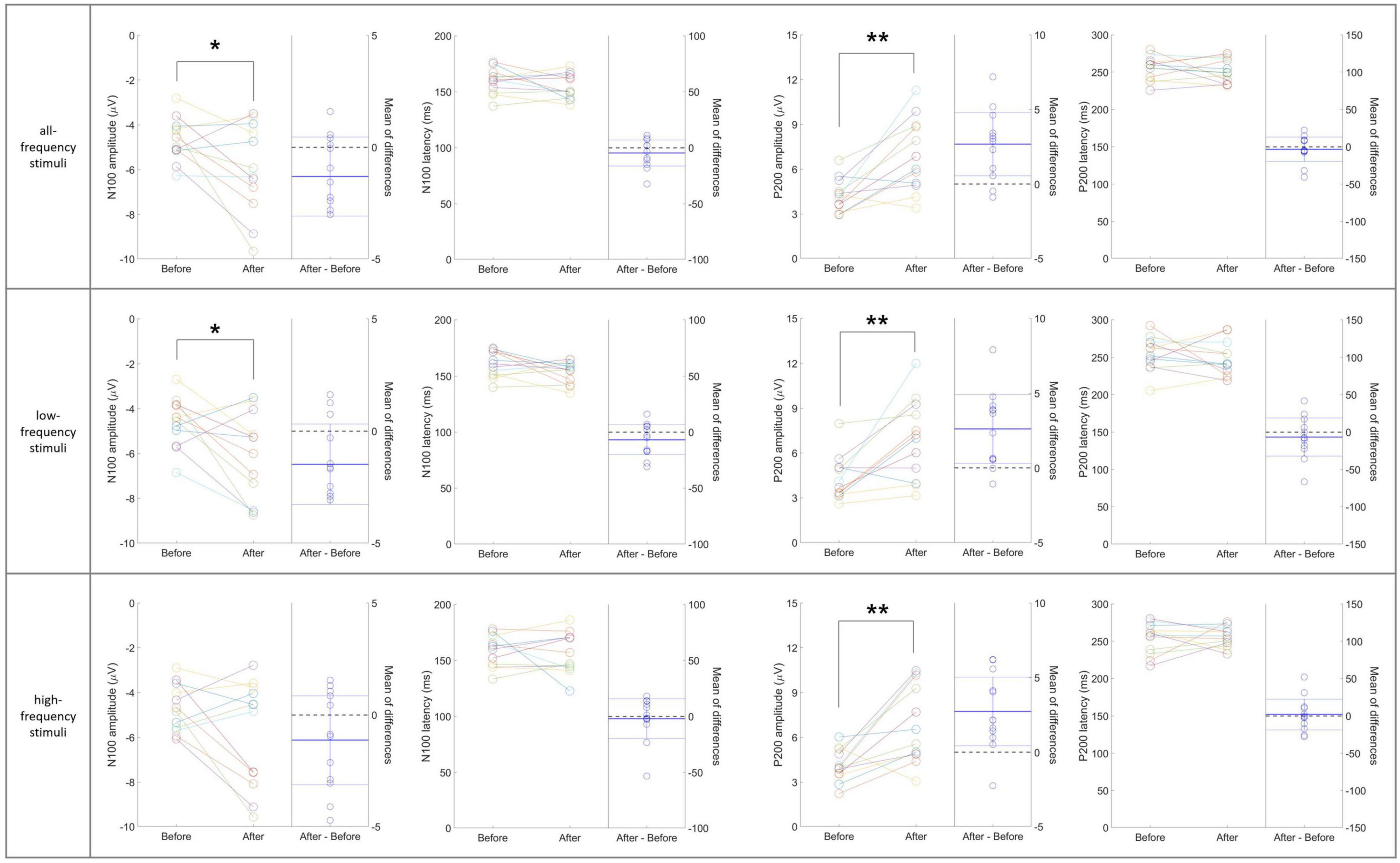 Twelve-panel chart showing N100 amplitude, P200 amplitude, and RTs before and after stimuli. Panels divided by all-frequency, low-frequency, and high-frequency stimuli. Statistical significance marked with asterisks. Lines connect data points, illustrating changes. Scales vary for each chart.