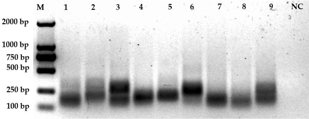 Gel electrophoresis image showing ten lanes labeled M, 1 to 9, and NC. The marker lane M has bands at 2000, 1000, 750, 500, 250, and 100 base pairs. Lanes 1 through 9 show faint bands of similar thickness at around 500 base pairs, while lane NC shows no visible bands.