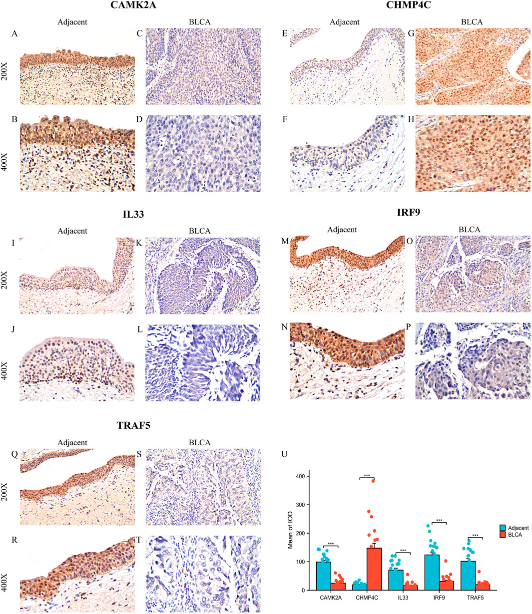 Histological images displaying adjacent and BLCA tissue stained for CAMK2A, CHMP4C, IL33, IRF9, and TRAF5 at 200X and 400X magnifications. The adjacent tissues show stronger staining compared to BLCA tissues in all cases. Additionally, a bar graph labeled