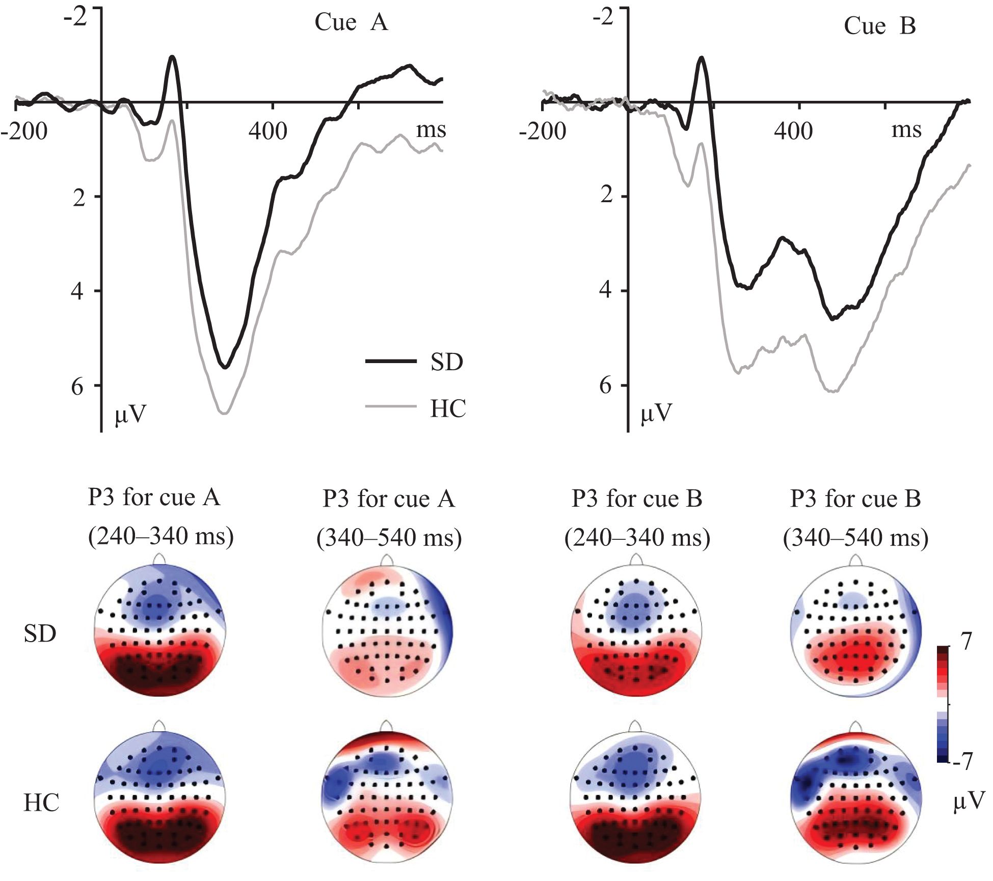 Graphs and scalp maps show EEG data for cues A and B. The graphs display microvolt changes over time, comparing SD and HC groups. Scalp maps depict P3 component distribution for each cue and time range, indicating varying levels of activation with color gradations from blue to red.