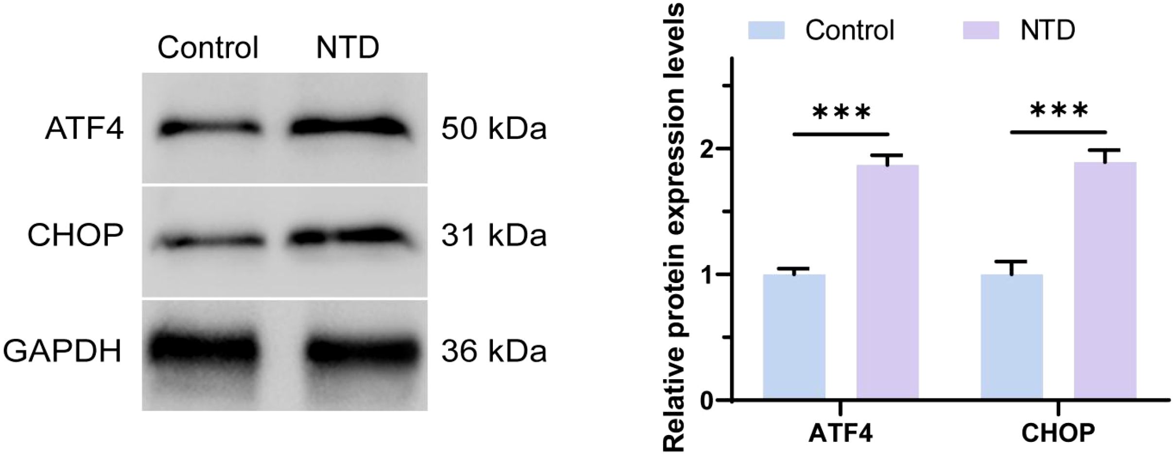 Western blot and bar graph comparing protein expression levels between control and NTD groups for ATF4 and CHOP proteins. The blot shows increased bands in the NTD group for both proteins, with molecular weights of 50 kilodaltons for ATF4 and 31 kilodaltons for CHOP. GAPDH is used as a loading control at 36 kilodaltons. The bar graph indicates significantly higher expression levels in the NTD group for both proteins, marked with three asterisks denoting statistical significance.