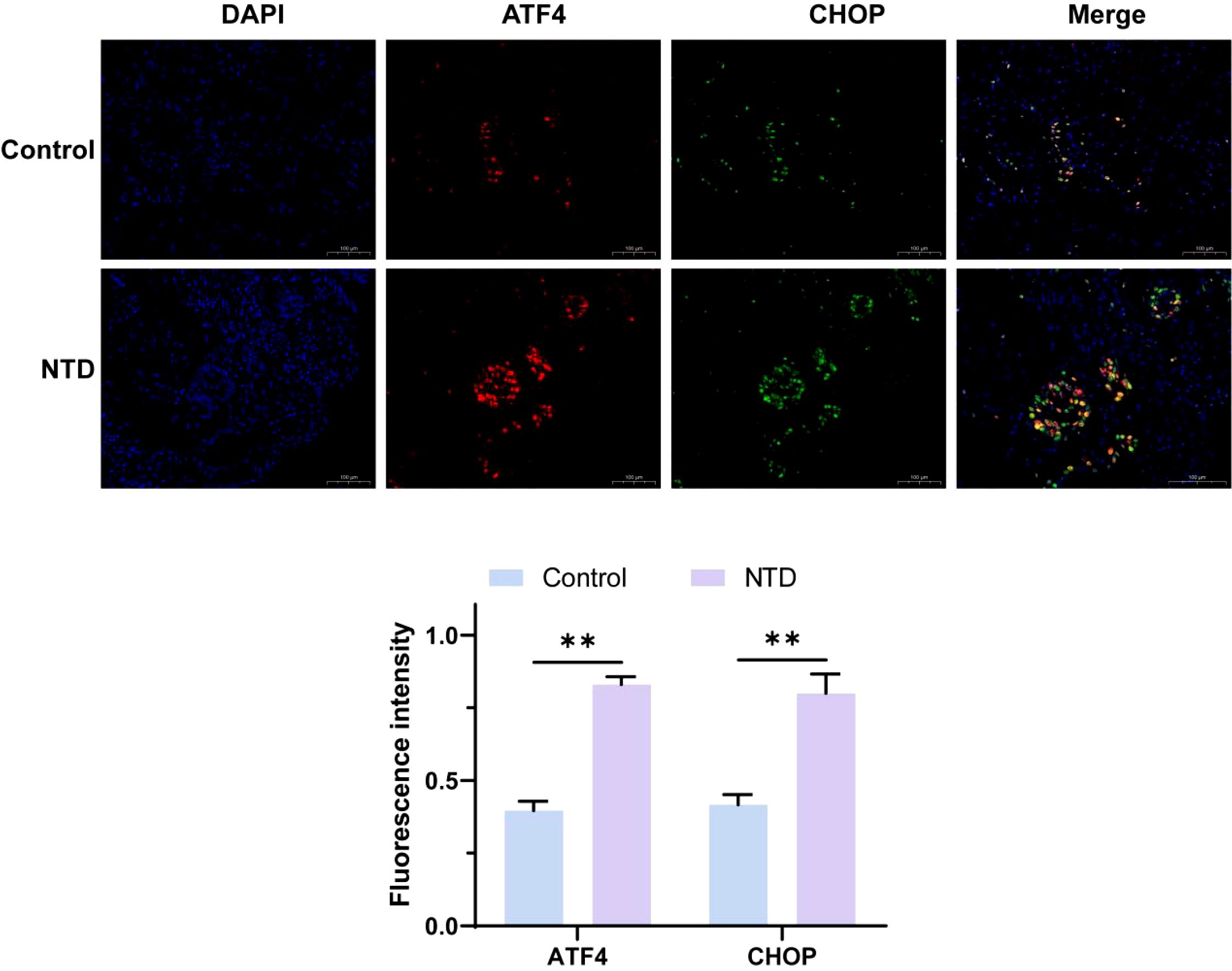 Fluorescent microscopy images showing expression of DAPI, ATF4, and CHOP in control and NTD samples. DAPI stains nuclei blue, ATF4 is red, CHOP is green, and merged images show overlap. A bar graph below compares fluorescence intensity between control and NTD for ATF4 and CHOP, indicating significant increases in NTD samples.